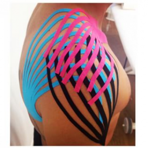 fisioterapia_kinesiotape