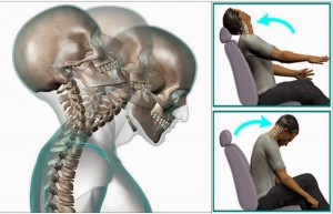 rehabilitacion-latigazo-cervical
