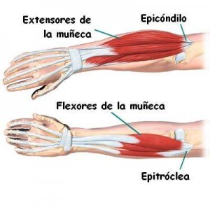 tendinitis de codo, fisioterapia