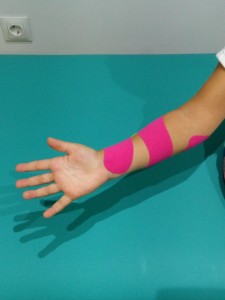 venmdaje neuromuscular, fisioterapia pediatrica