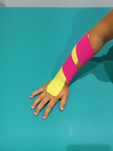 vendaje neuromuscular, supinacion miembro superior