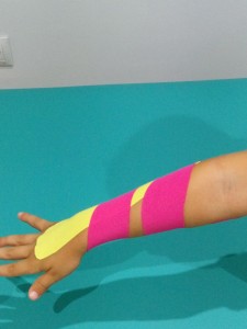 vendaje neuromuscular, espasticidad, supinacion